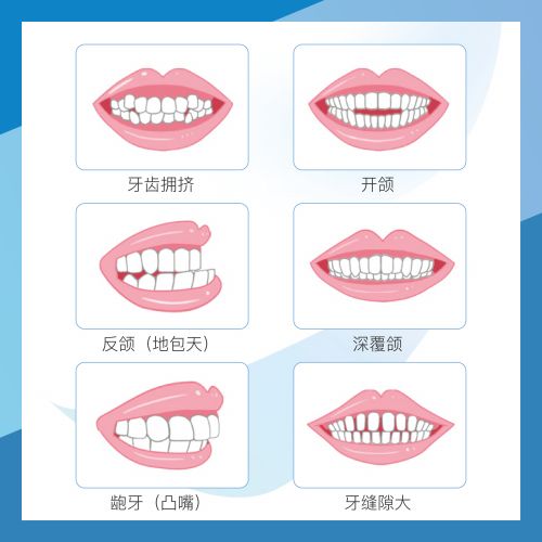 微创牙周治疗